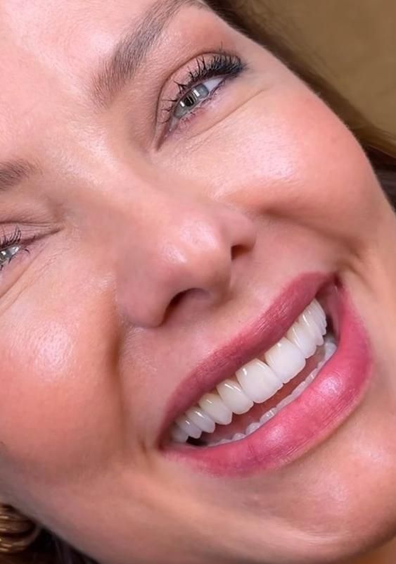 دندان ، دندانپزشکی ، لمینت ، کامپوزیت ، ایمپلنت|خدمات آرایشگری و زیبایی|مشهد, دانشجو|دیوار