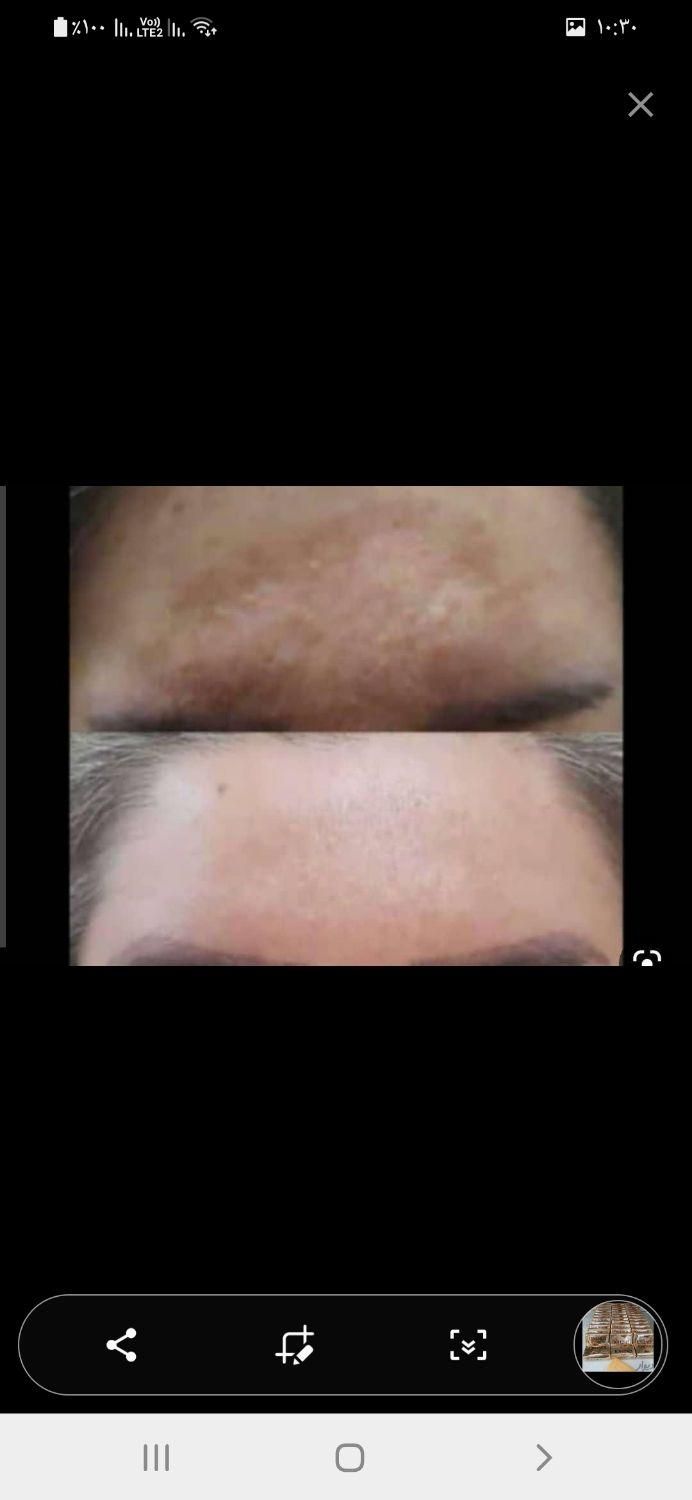 کرم معجزه صابون صندل ۱۲۵گرمی|آرایشی، بهداشتی، درمانی|ورامین, ورامین|دیوار