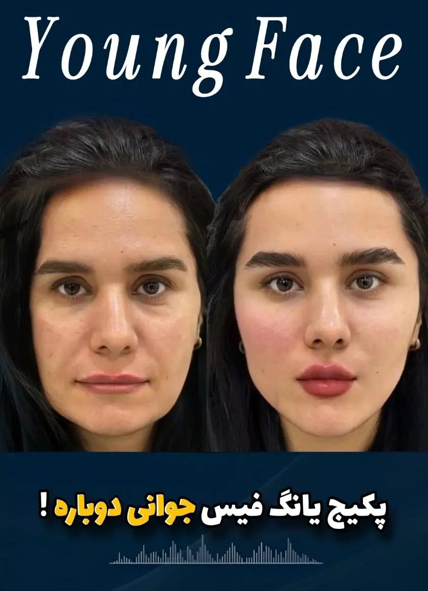 آف فیلر بادی سینه باسن بیکینی دست لاغری شکم Drزنان|خدمات آرایشگری و زیبایی|مشهد, هفت تیر (حافظ)|دیوار