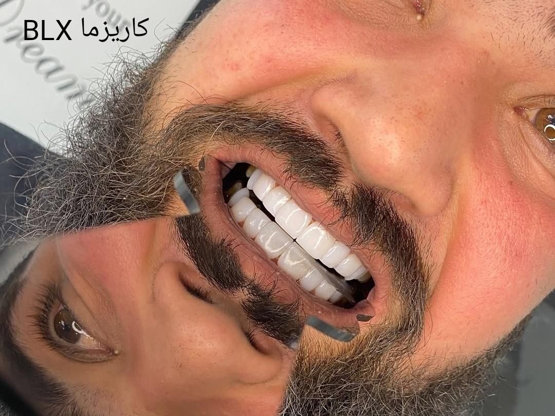 مرکز خدمات کامپوزیت دندان شیراز دندانپزشکی|خدمات آرایشگری و زیبایی|شیراز, قصرالدشت|دیوار