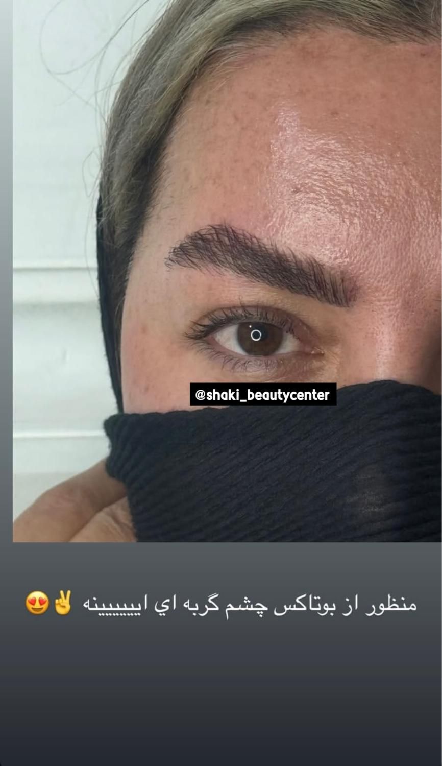 مدل بوتاکس و پی ار پی و کانتورینگ صورت با فیلر|خدمات آرایشگری و زیبایی|اصفهان, ملک‌شهر|دیوار