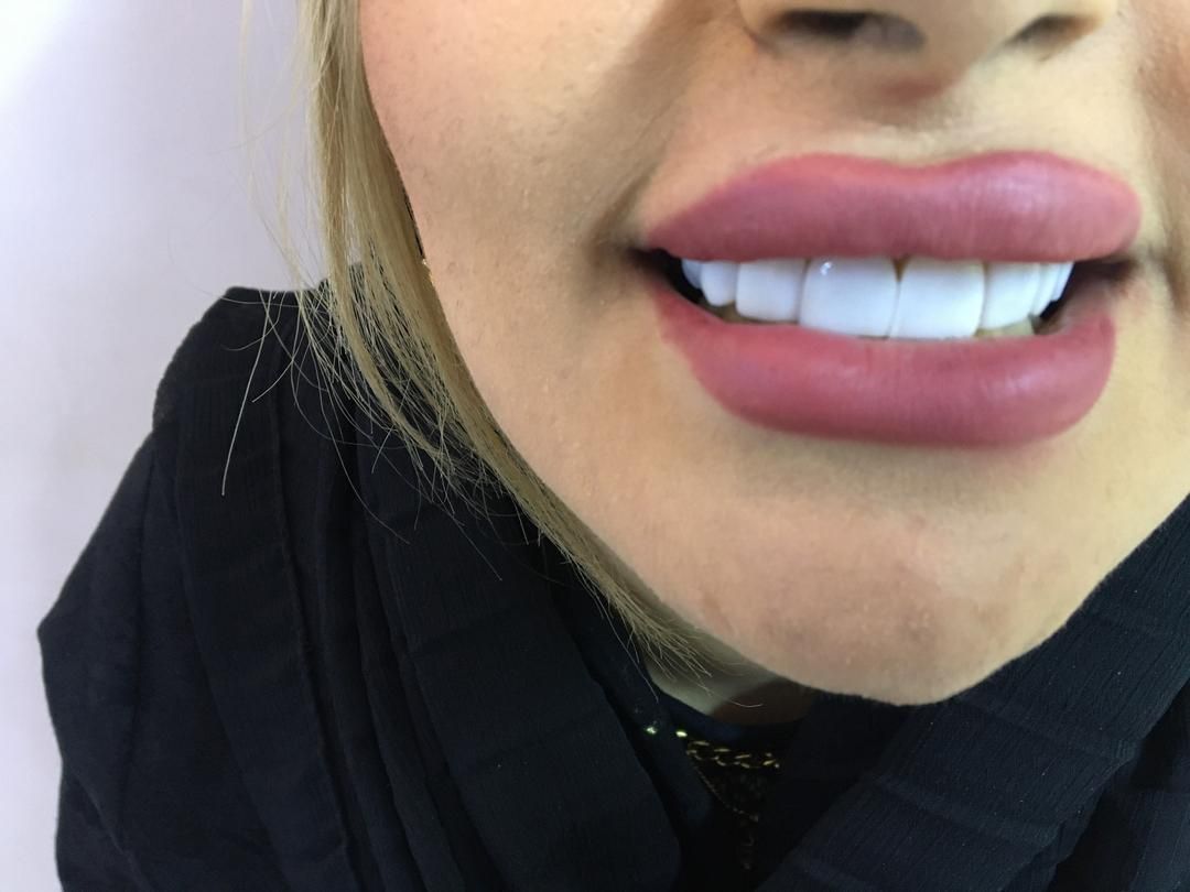 دندانپزشکی انجام تمامی خدمات دندانپزشکی|خدمات آرایشگری و زیبایی|تبریز, |دیوار