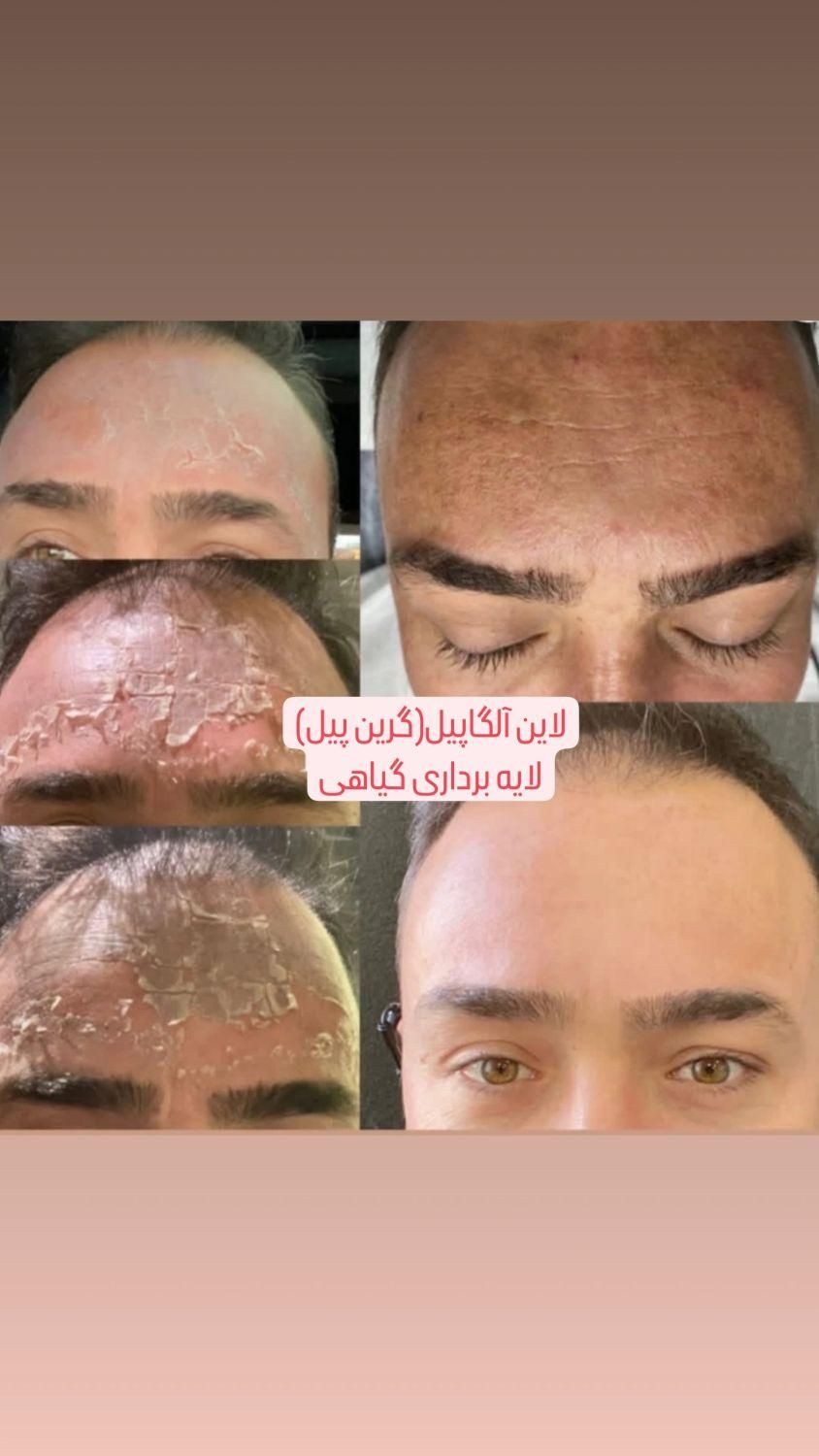 آلگاپیل،فیشال (خانمها و آقایان)|خدمات آرایشگری و زیبایی|یاسوج, |دیوار