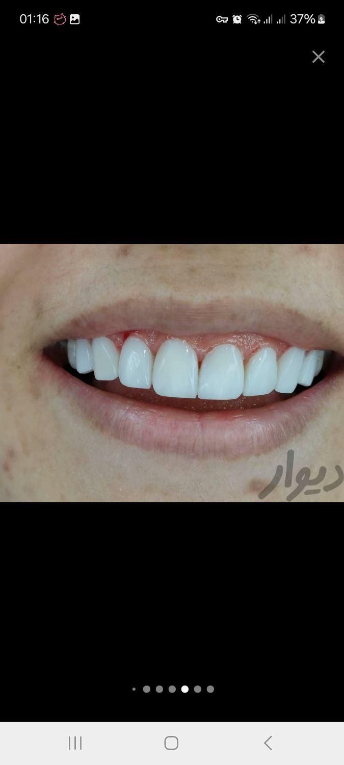 دندانپزشکی با بیمه تکمیلی و آزاد / بدون پیش|خدمات آرایشگری و زیبایی|بهبهان, |دیوار