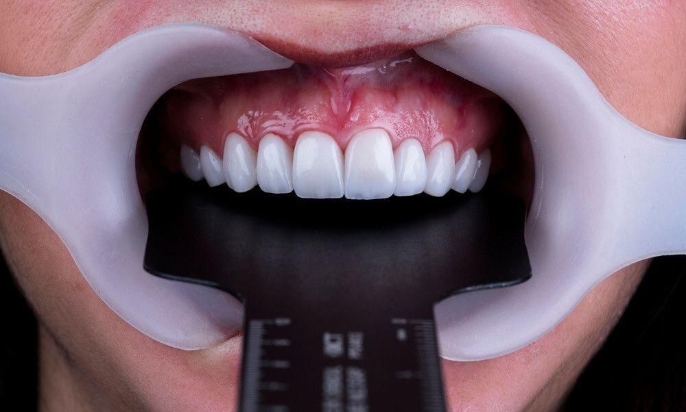 خدمات دندانسازی و دندانپزشکی با تعرفه ویژه|خدمات آرایشگری و زیبایی|شیراز, هفت تنان|دیوار