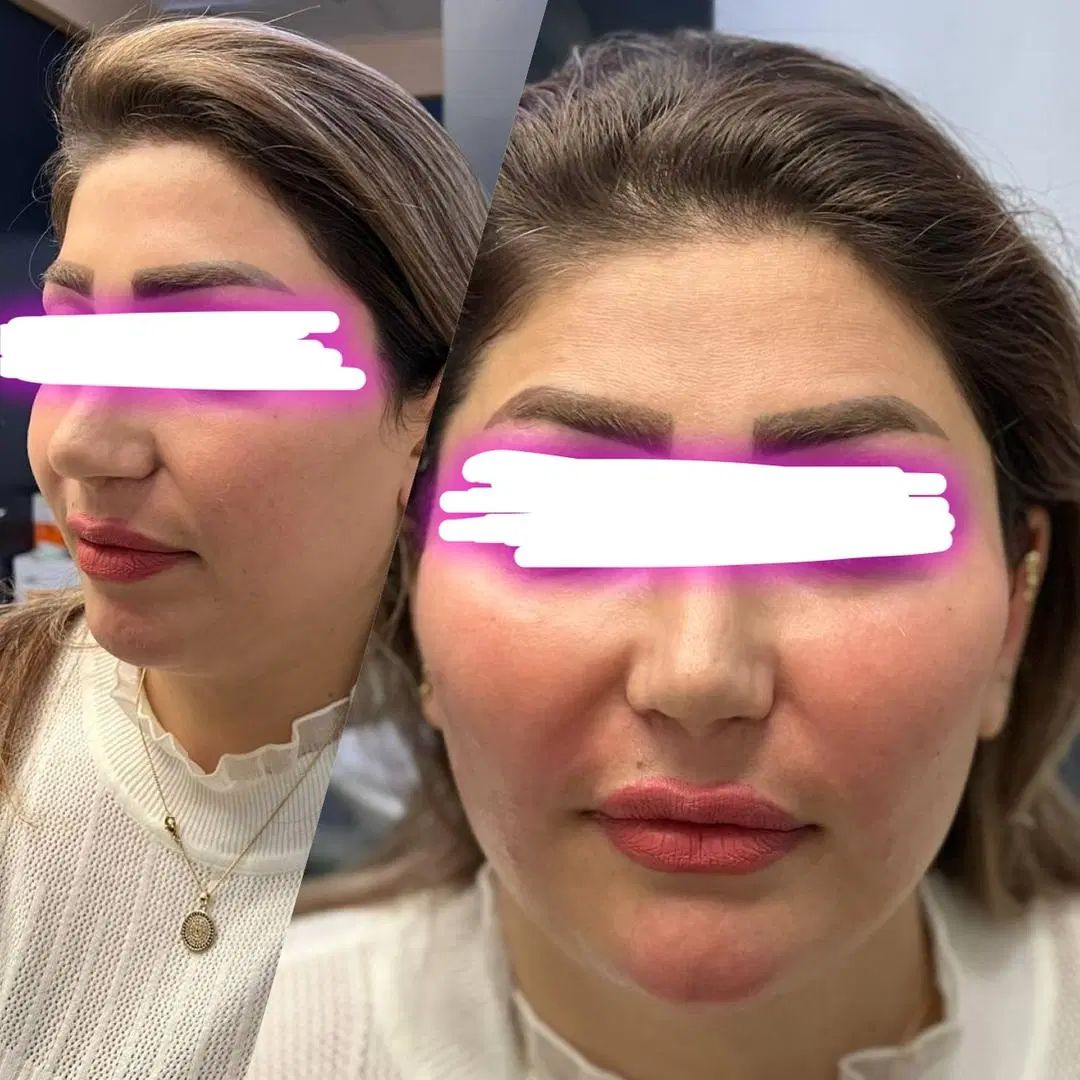 تاریخ تخفیف ۹شهریور فقط یک روزه ۴۵۰هزارتومان|خدمات آرایشگری و زیبایی|رشت, گلسار|دیوار