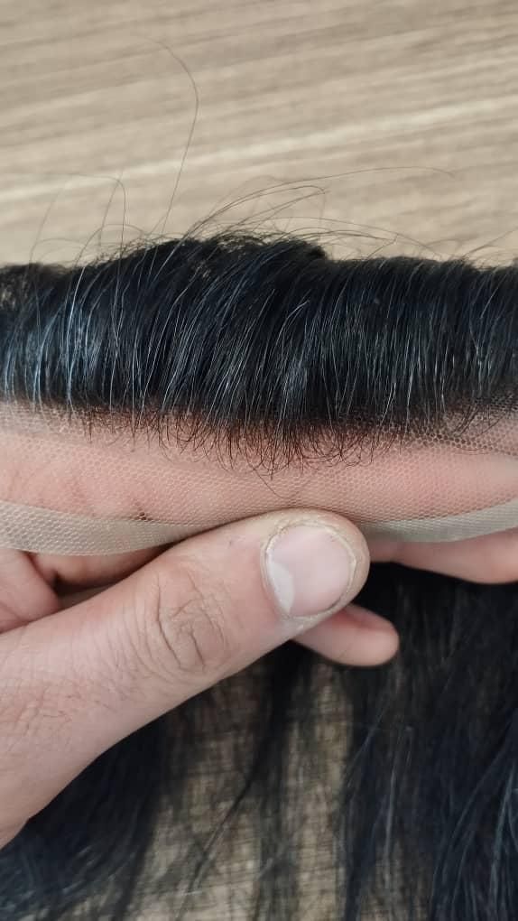 پروتز مو|خدمات آرایشگری و زیبایی|فردیس, طالقانی|دیوار