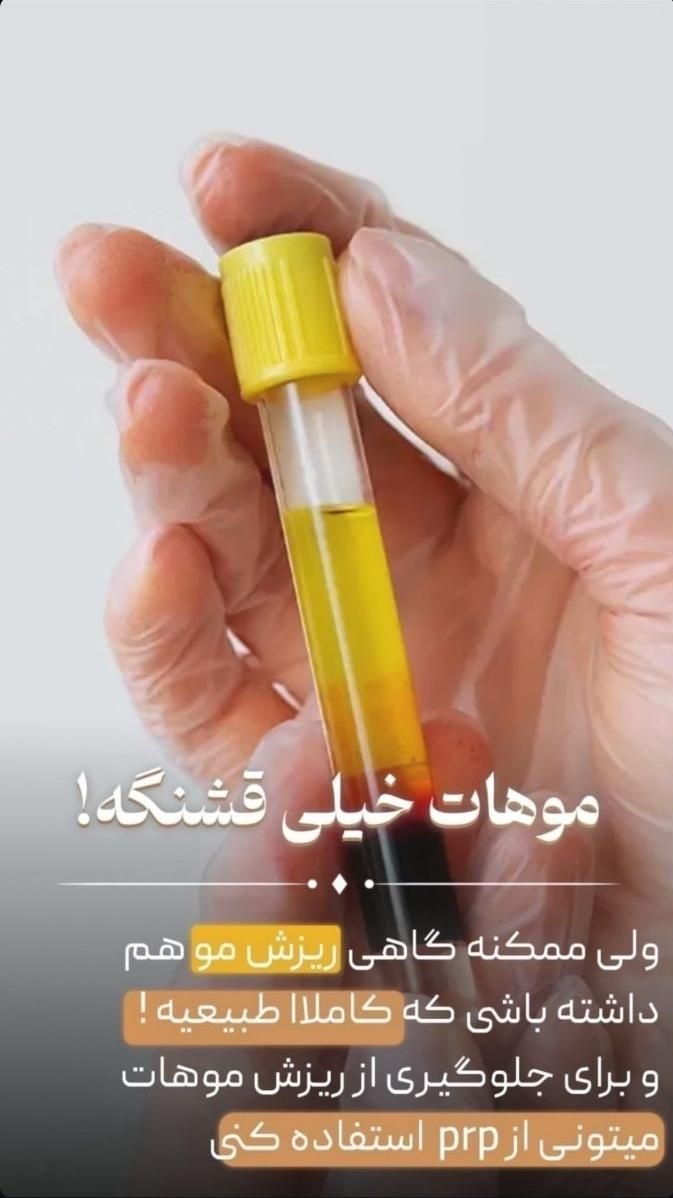 جوانسازی با پی آرپی فقط ۵۰۰ تومان|خدمات آرایشگری و زیبایی|مشهد, رضاشهر|دیوار