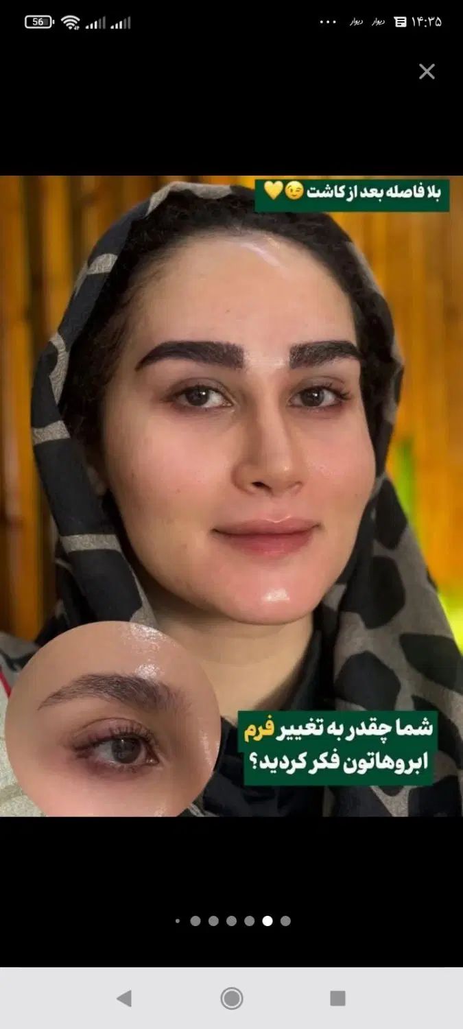آموزش جراحی صورت کاشت ابرو بلفاروپلاسی ساکشن غبغب|خدمات آموزشی|اصفهان, خواجو|دیوار