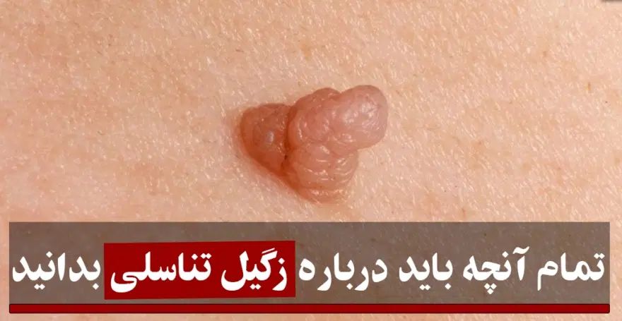 کمک به درمان زگیل تناسلی‌و..|آرایشی، بهداشتی، درمانی|مشهد, کوه سنگی|دیوار