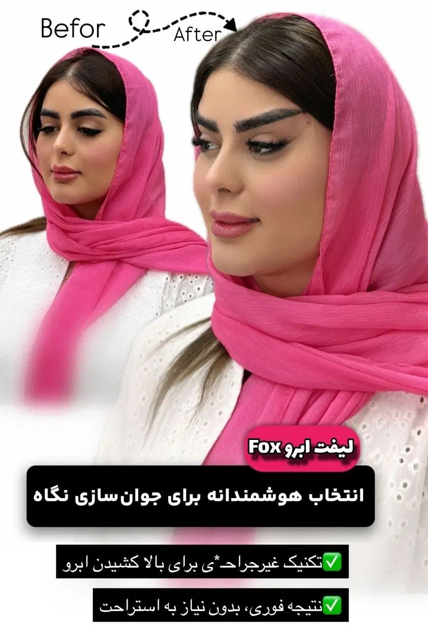 آف پکیج تخصصی FOX EYE پزشک پوست مو بینی زیبایی|خدمات آرایشگری و زیبایی|مشهد, هنرستان|دیوار