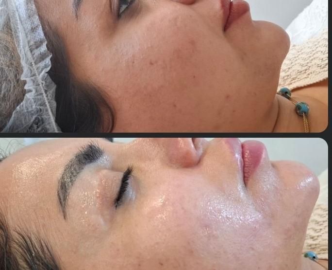 فیشال و پاکسازی پوست|خدمات آرایشگری و زیبایی|اصفهان, دشتستان|دیوار