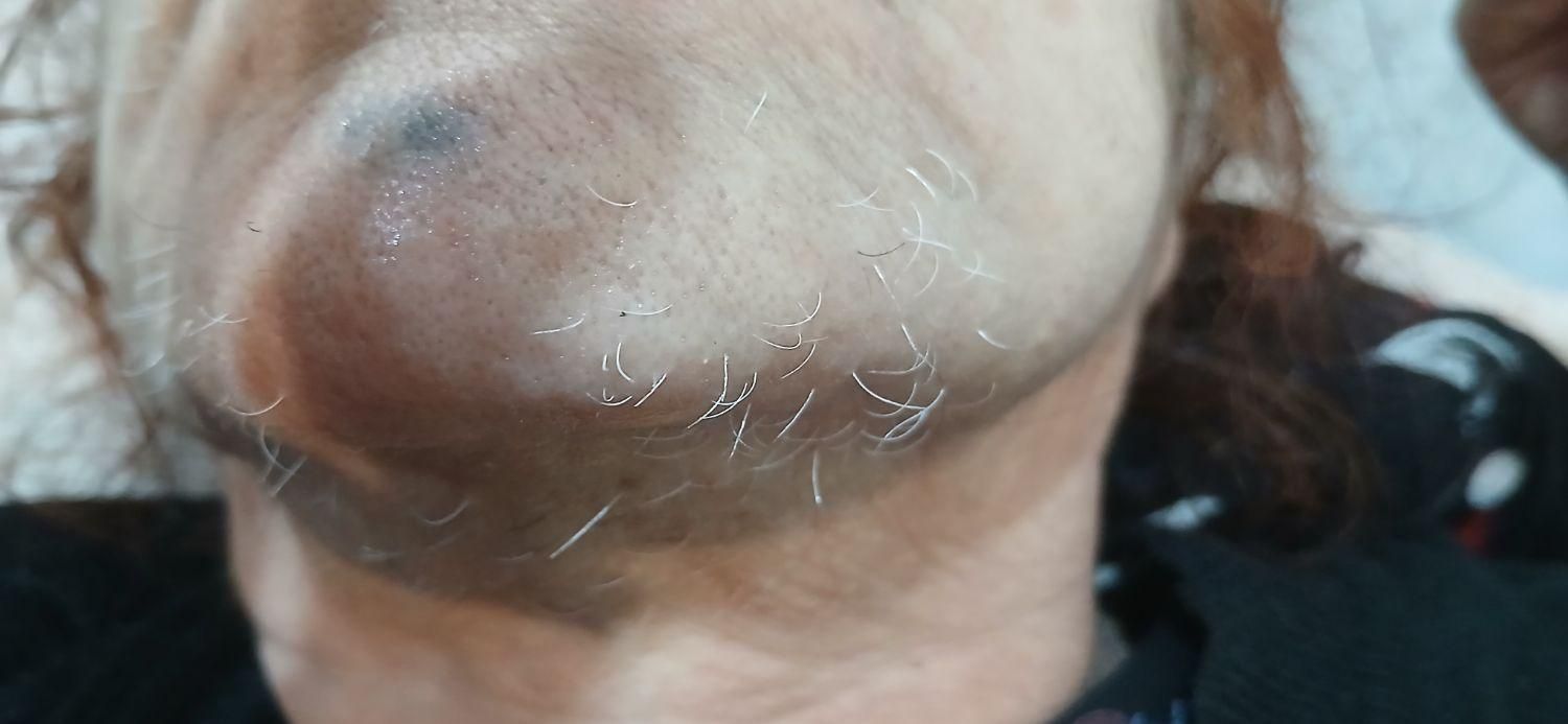 الکترولیز موی سفید وسیاه صورت بانوان فقط|خدمات آرایشگری و زیبایی|بروجرد, |دیوار