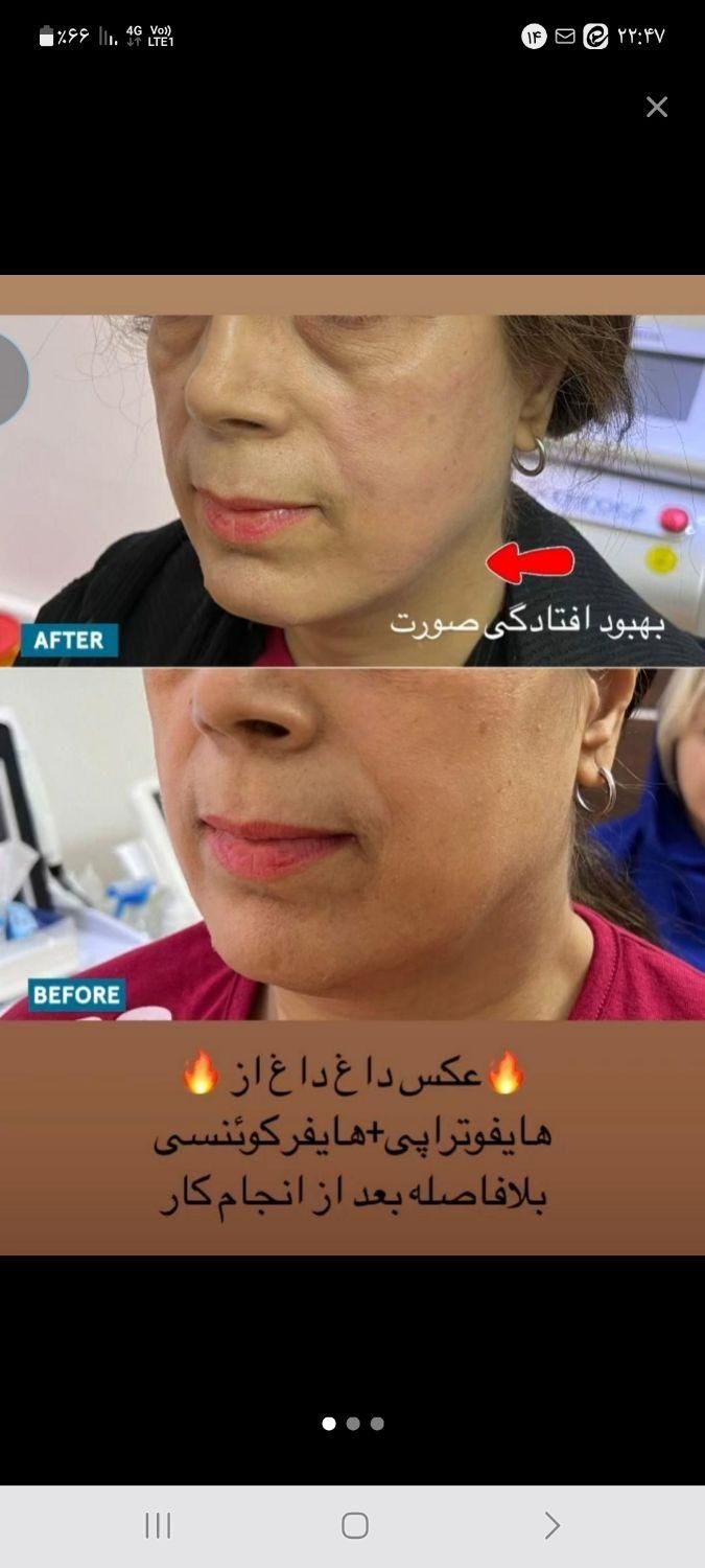 واگذاری کامل کلینیک زیبایی|اجارهٔ دفتر کار، اتاق اداری، مطب|تهران, شهرک ولیعصر جنوبی|دیوار