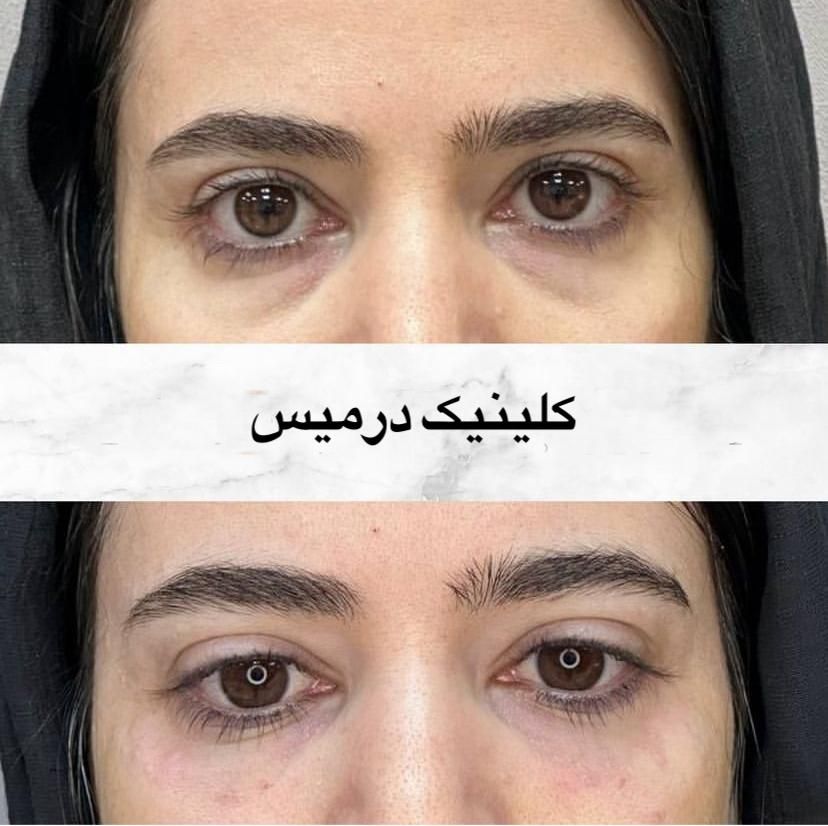 مرکز همیشه تخفیف زیبایی پوست بانوان لیزر بوتاکس مو|خدمات آرایشگری و زیبایی|کرج, گوهردشت|دیوار