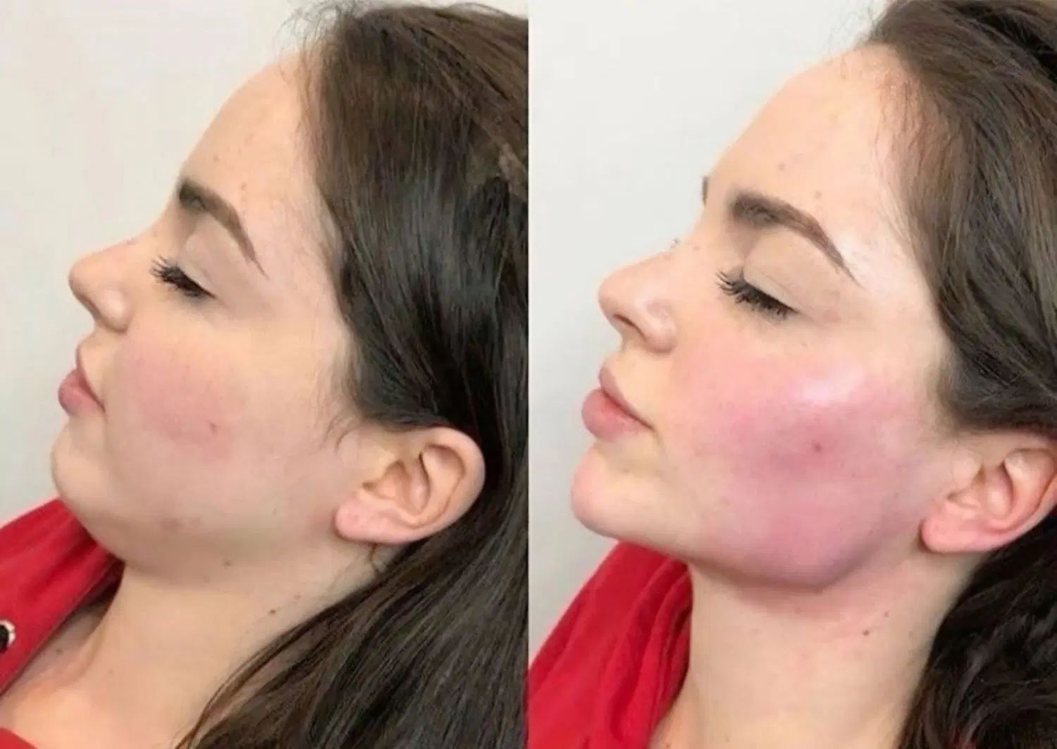 خدمات با تخفیف ژل و بوتاکس مزوژل در کلینیک پزشک|خدمات آرایشگری و زیبایی|اصفهان, وحید|دیوار