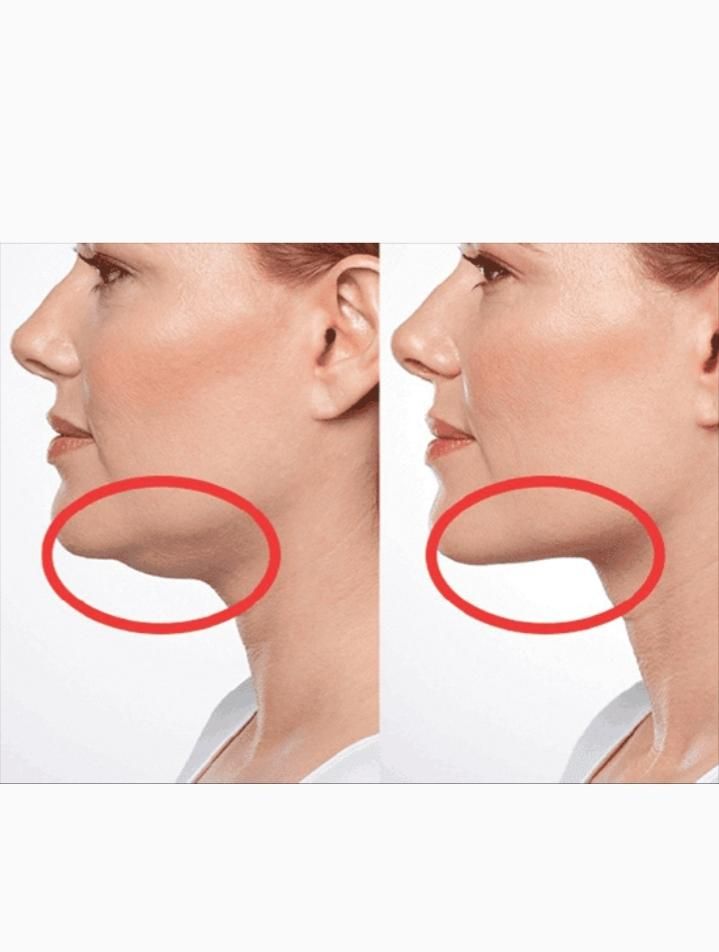عمل رفع غبغب|خدمات آرایشگری و زیبایی|خمینی‌شهر, |دیوار