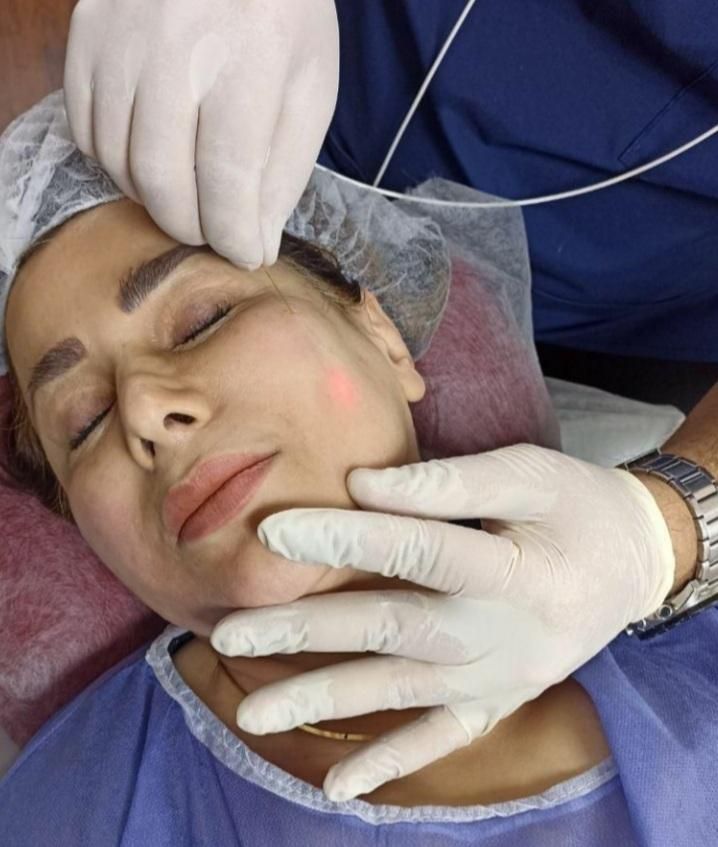اندولیفت/ جوانسازی /تخلیه چربی صورت / رفع سلولیت|خدمات آرایشگری و زیبایی|تهران, صادقیه|دیوار
