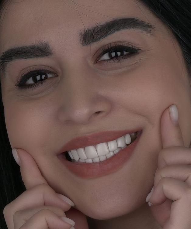 دندان ، دندانپزشکی ، لمینت ، کامپوزیت ، ایمپلنت|خدمات آرایشگری و زیبایی|مشهد, دانشجو|دیوار