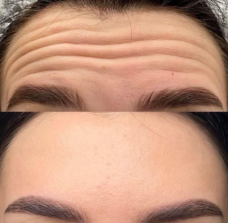 فیلر زیر چشم،ژل ،بوتاکس ،خدمات جوانسازی صورت|خدمات آرایشگری و زیبایی|اندیشه, اندیشه فاز ۱|دیوار