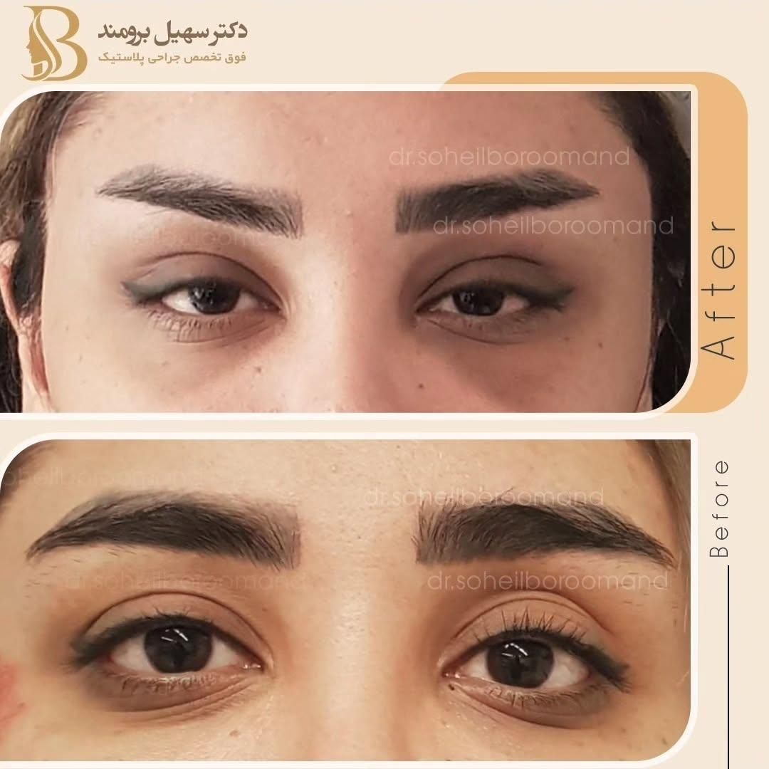 لیپوماتیک/ابدومینوپلاستی/پروتز سینه/مامو/لیفت|خدمات آرایشگری و زیبایی|تهران, سعادت‌آباد|دیوار