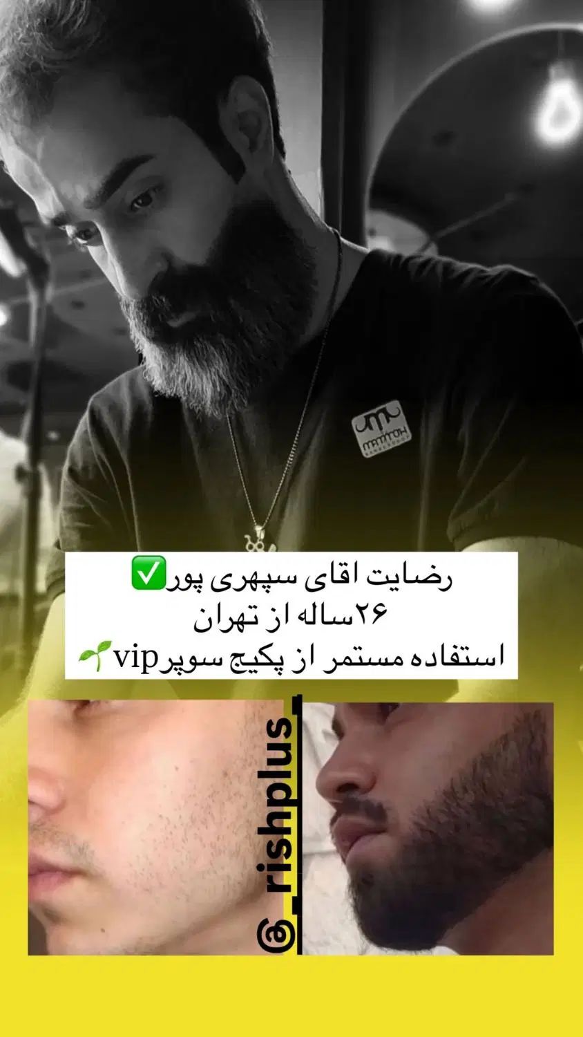 رشد ریش تضمینی|آرایشی، بهداشتی، درمانی|تهران, آبشار|دیوار