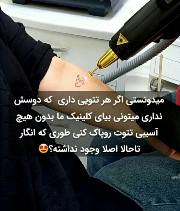 لیزر موهای زائد، ریمو تتو، خالبرداری زگیل میخچه|خدمات آرایشگری و زیبایی|ارومیه, |دیوار