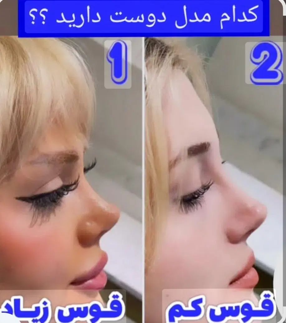 عمل بینی۲۰ میلیون قسطی با شرایط فوق العاده عالی|خدمات آرایشگری و زیبایی|مشهد, احمدآباد|دیوار