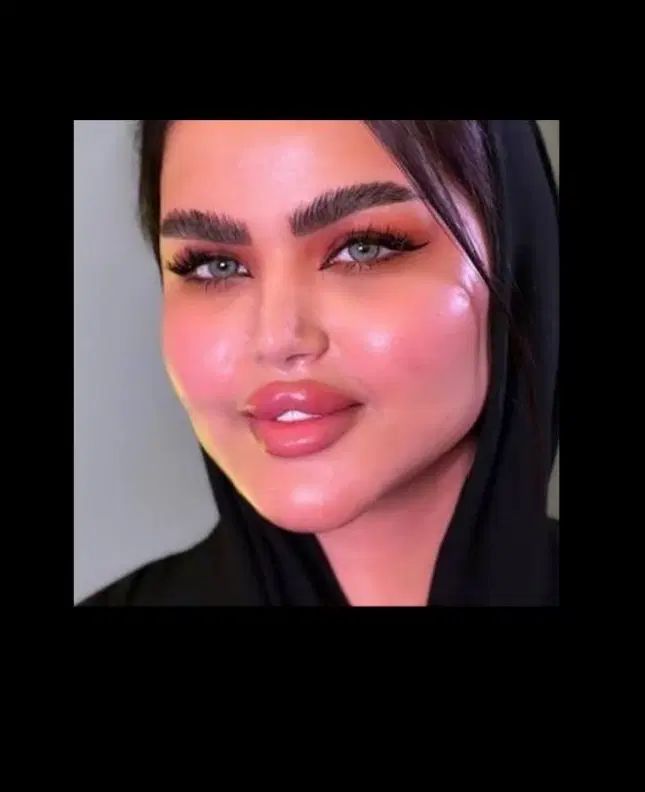 ژل/بوتاکس/چربی/مزوژل/وآموزش گروهی وخصوصی|خدمات آرایشگری و زیبایی|اهواز, گلستان|دیوار