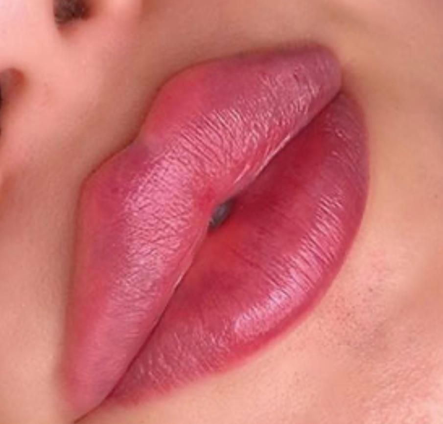 تزریق ژل و بوتاکس|خدمات آرایشگری و زیبایی|اصفهان, سنبلستان|دیوار