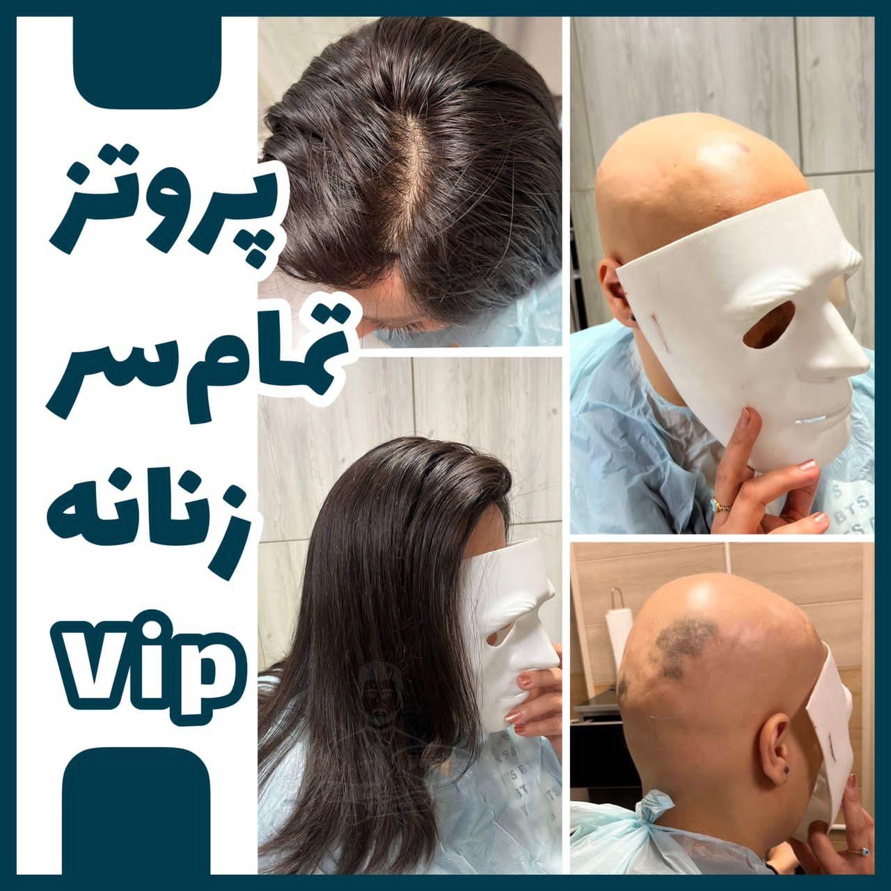 پروتزمو (دکترپروتز)|خدمات آرایشگری و زیبایی|اصفهان, هزارجریب|دیوار