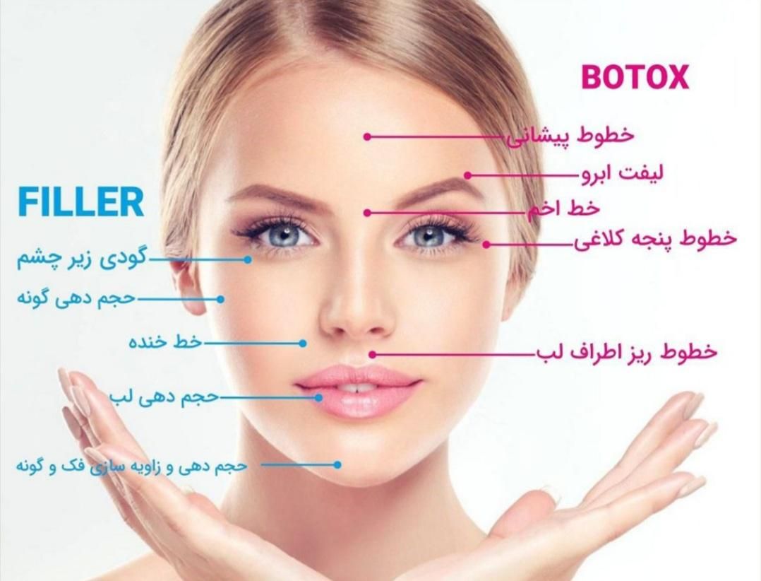 تزریق ژل فیلر بوتاکس مزوتراپی مو ابرو صورت پی آرپی|خدمات آرایشگری و زیبایی|اهواز, نادری|دیوار