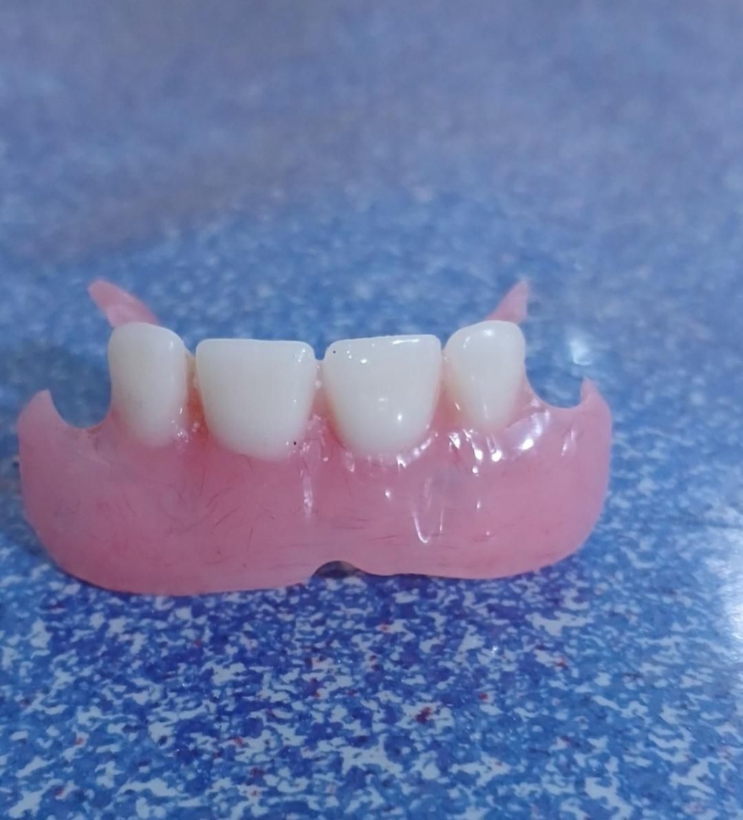 ساخت دندان مصنوعی متحرک|خدمات آرایشگری و زیبایی|صدرا-فارس, |دیوار