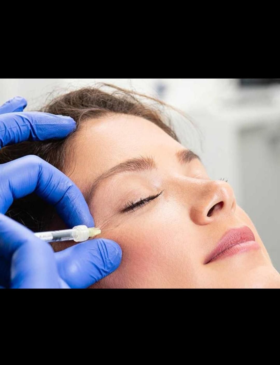 جشنواره *هفت روزه*تزریق ژل و بوتاکس،فیلر،مزوتراپی|خدمات آرایشگری و زیبایی|یاسوج, |دیوار