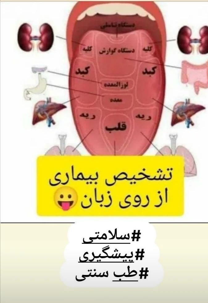 تشخیص عارضه ها از روی زبان|خوردنی و آشامیدنی|تهران, اختیاریه|دیوار