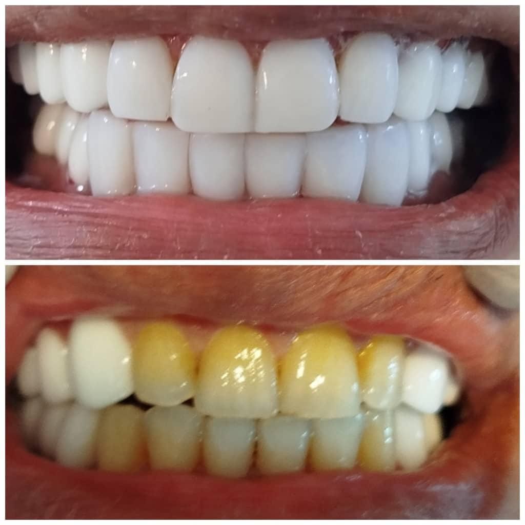 دندانپزشکی لبخند|خدمات آرایشگری و زیبایی|پاکدشت, پاکدشت (مامازند)|دیوار