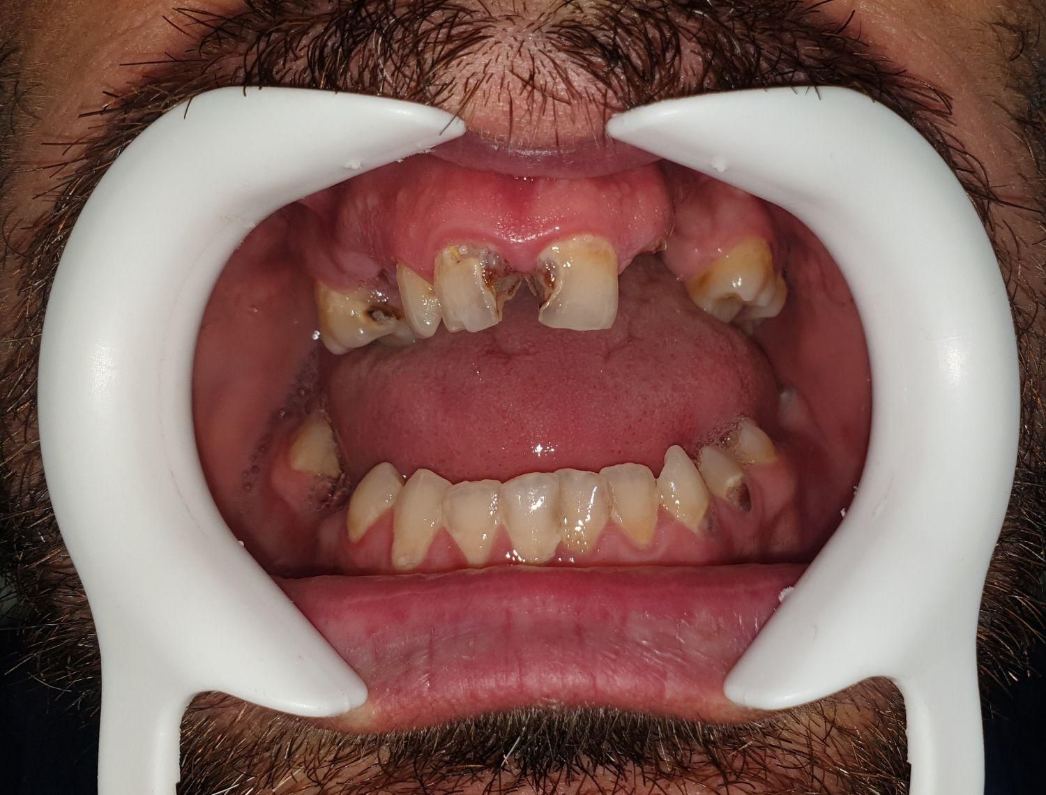 خدمات دندانپزشکی برلیان|خدمات آرایشگری و زیبایی|بانه, |دیوار