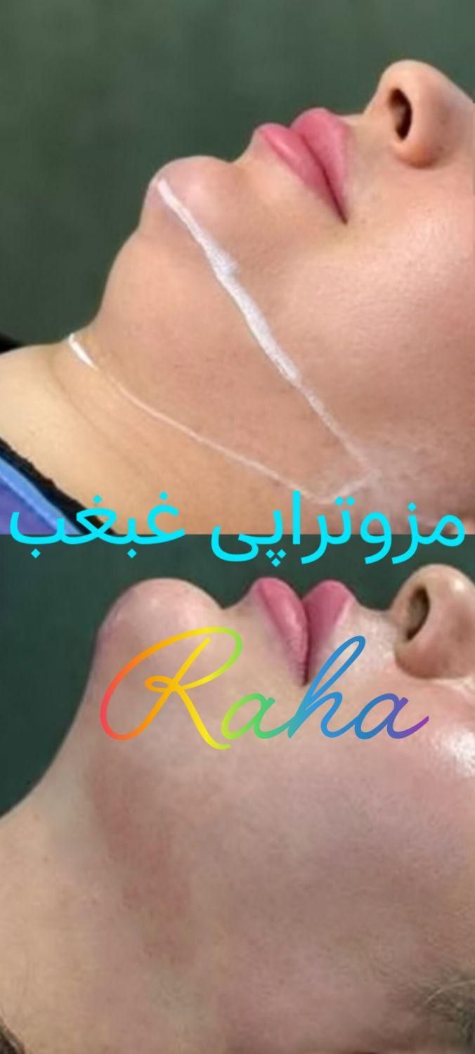 ژل/بوتاکس/آنزیم/مزو فقط ۳۰۰|خدمات آرایشگری و زیبایی|کرج, گوهردشت|دیوار