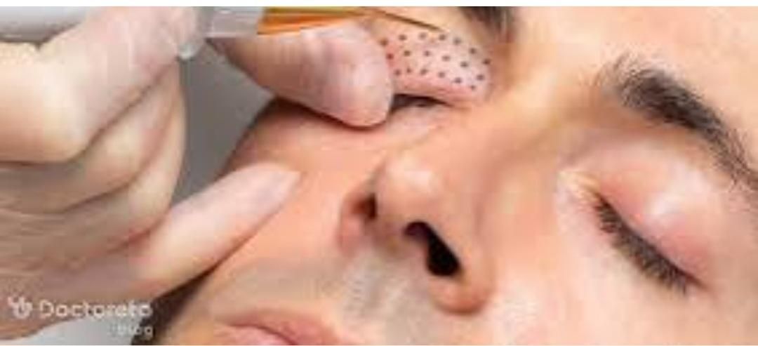 کارپاکسازی صورت وپلاسماتراپی|خدمات آرایشگری و زیبایی|اصفهان, ارزنان|دیوار