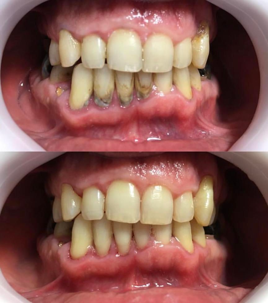 انجام خدمات جرمگیری دندان و ترمیم دندان های پوسیده|خدمات آرایشگری و زیبایی|آبادان, |دیوار