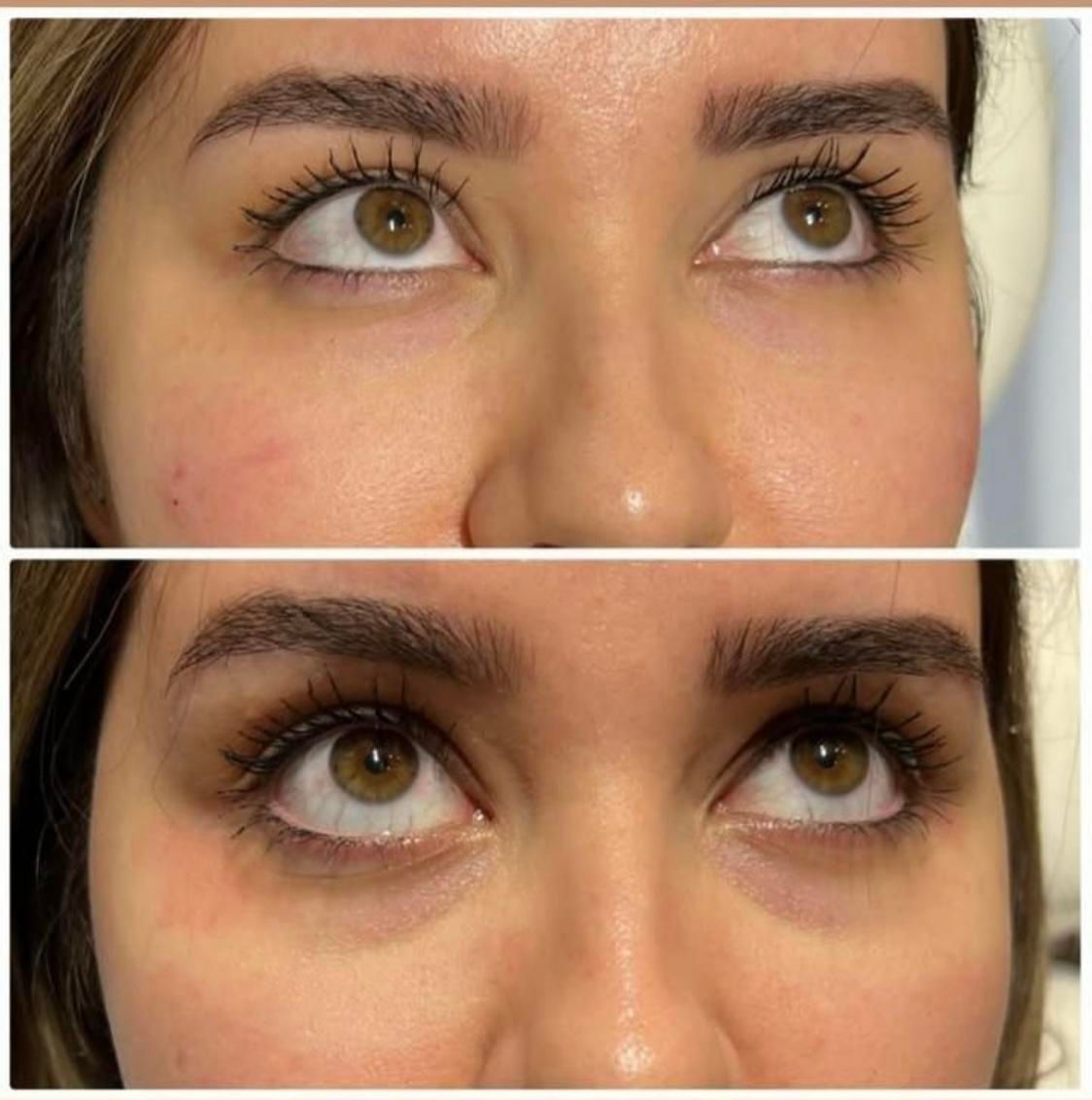 کلینیک تزریق ژل390لیفت بوتاکس لیزر /جالپرو پروفایل|خدمات آرایشگری و زیبایی|تهران, صادقیه|دیوار