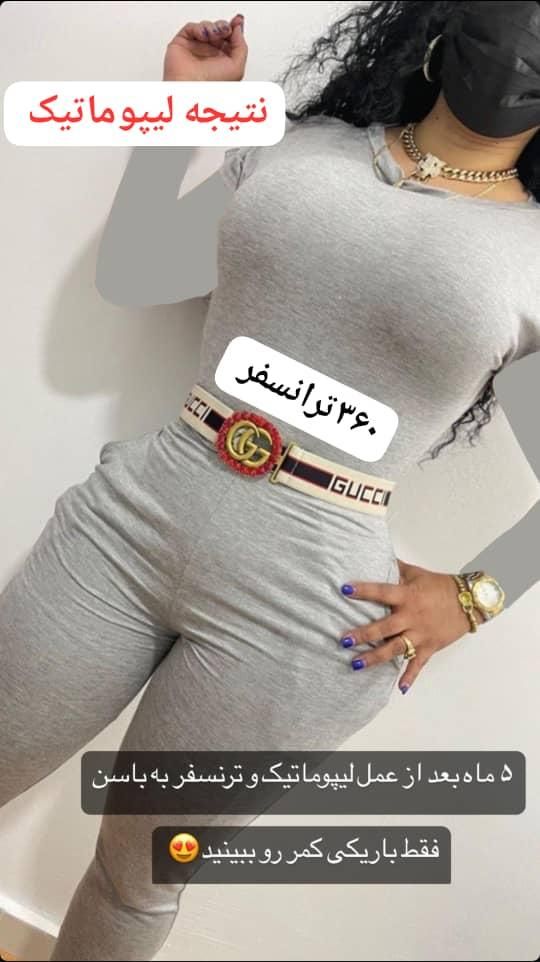 عمل های زیبایی و جراحی های تخصصی پیکرتراشی دکتریاب|خدمات آرایشگری و زیبایی|شیراز, زند|دیوار