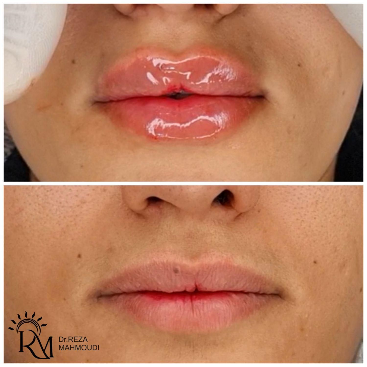 جشنواره  زیبایی کلینیک دکتر محمودی|خدمات آرایشگری و زیبایی|کرمان, |دیوار