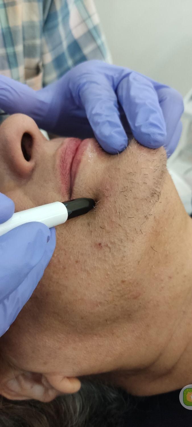 لیزر موهای زائد و الکترولیز|خدمات آرایشگری و زیبایی|فولادشهر, B5|دیوار