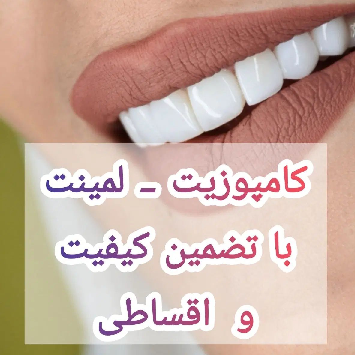 کامپوزیت دندان بااطمینان ازنتیجه(دندانپزشکی تخصصی)|خدمات آرایشگری و زیبایی|اصفهان, میرعماد|دیوار