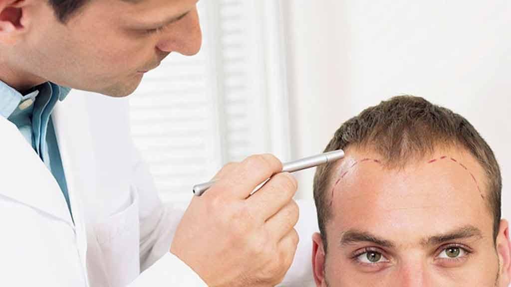 کاشت مو/پیوند مو/کاشت ابرو/کاشت ریش|خدمات آرایشگری و زیبایی|شیراز, وحدت|دیوار
