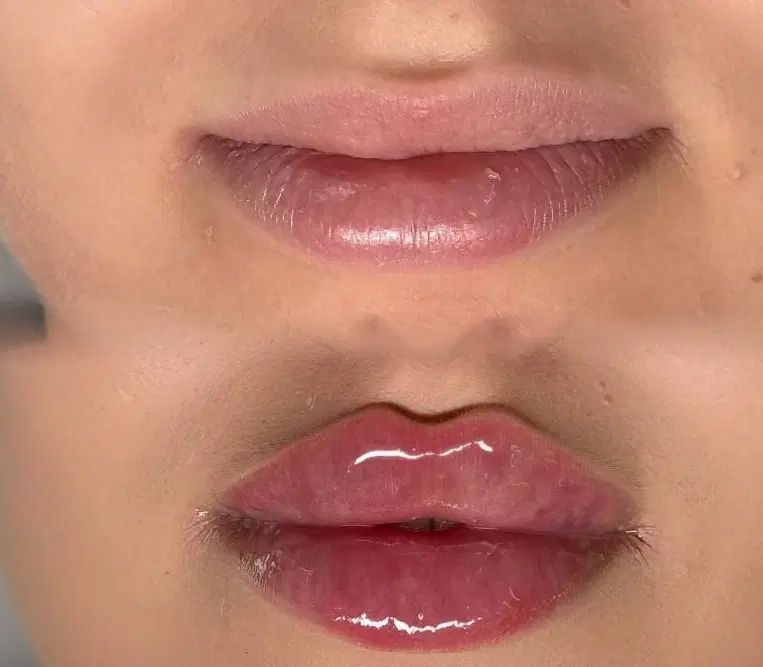 آموزش فیلر چونه بوتاکس ژل لب مزوژل پرسینگ|خدمات آرایشگری و زیبایی|مشهد, موسوی قوچانی|دیوار