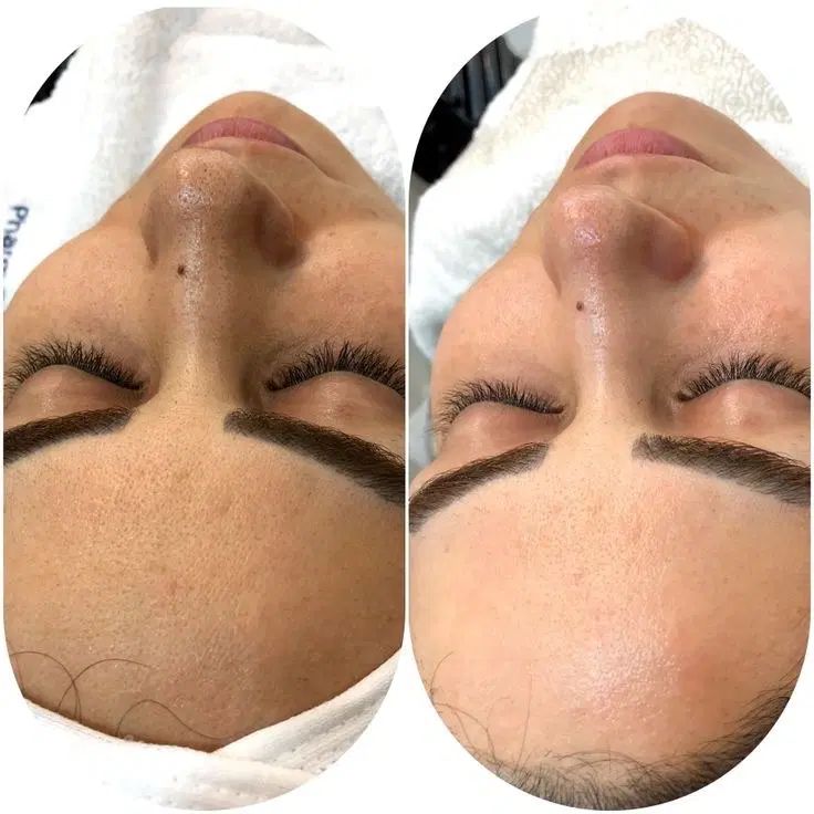 فشیال تخصصی و پاکسازی پوست در محیطی لوکس و آرام -|خدمات آرایشگری و زیبایی|قم, زنبیل آباد|دیوار