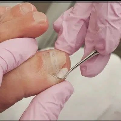 جراحی ناخن لیپوم توده چربی ختنه ژل بوتاکس|خدمات آرایشگری و زیبایی|مشهد, طلاب|دیوار