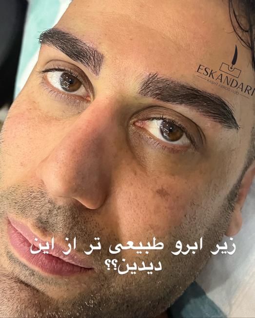 جشنواره کاشت ابرو سبک تهرانی و کاشت مو|خدمات آرایشگری و زیبایی|مشهد, وکیل‌آباد|دیوار